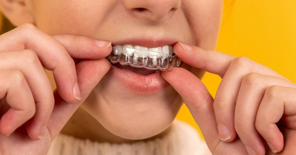 Invisalign Clear Aligners